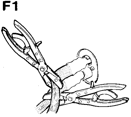 S8701720