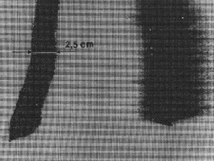 S8000113